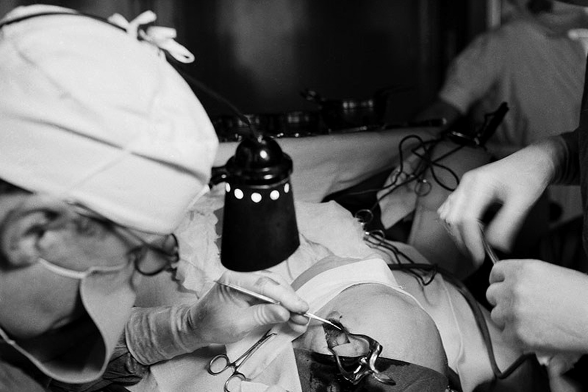 Lobotomy, 1949