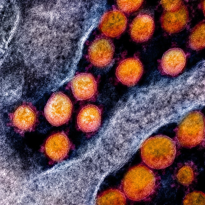 Transmission electron micrograph of SARS-CoV-2 particles (NIAID Integrated Research Facility; CC BY 2.0). Colors are laboratory enhancement, not natural optical colors.